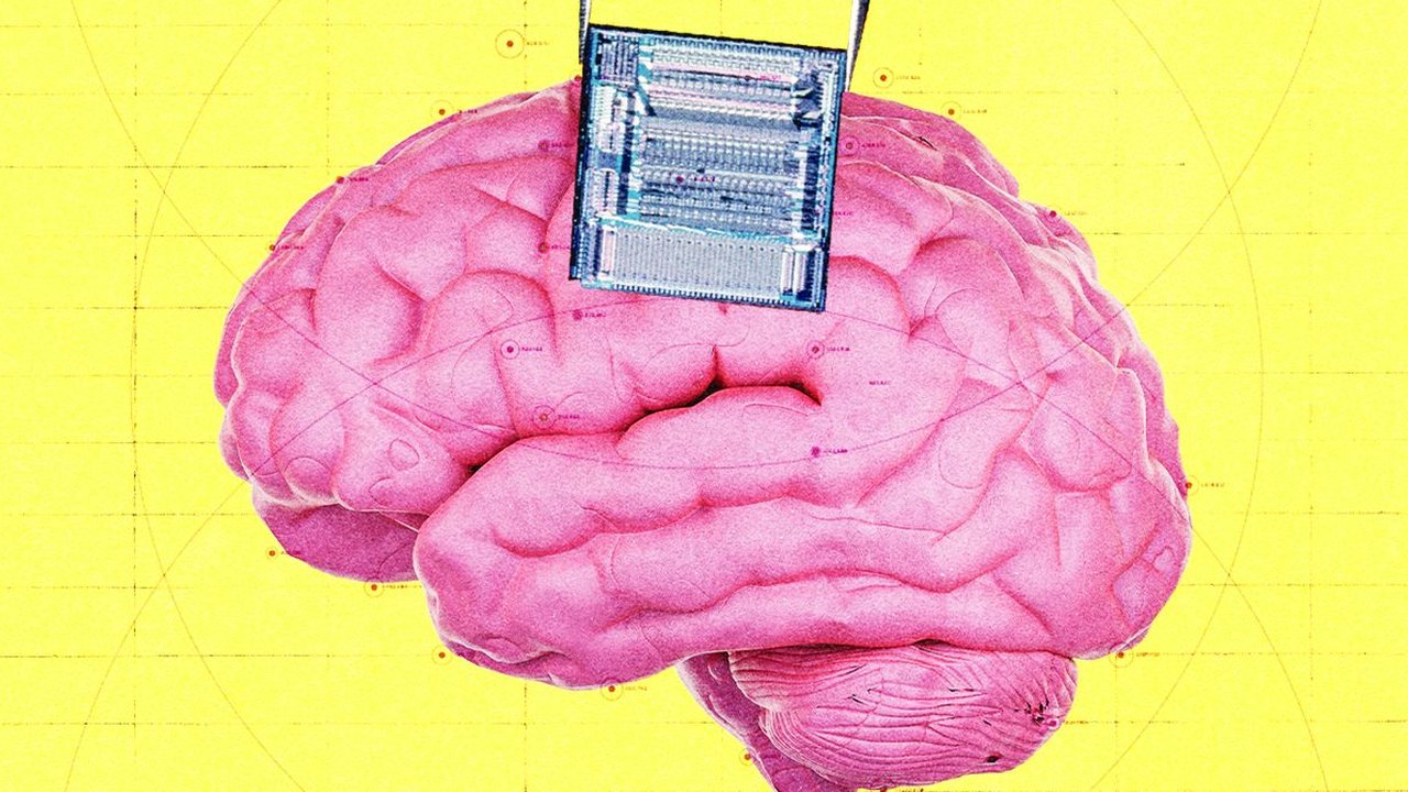 OpenAI Venture Fund Backs Startup Developing Brain Implants for Cancer Detection and Treatment
